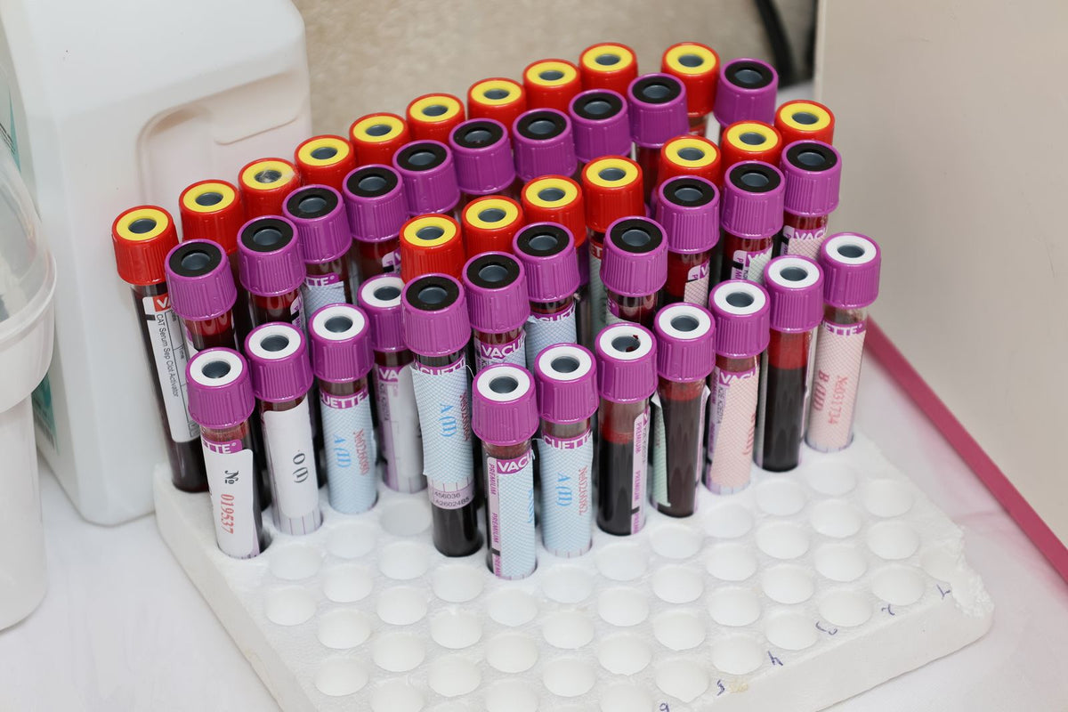 Blood sample vials in a laboratory rack, ready for testing